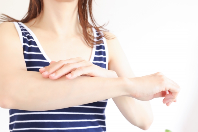 女性の腕に湿疹